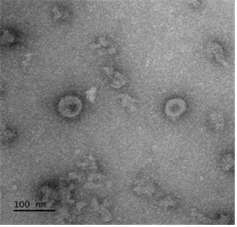 코로나19 바이러스항원(Spike)으로 구성된 바이러스유사체 투과전자현미경 (TEM) 이미지(사진=질병관리본부)